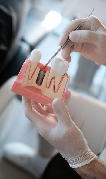 K�p - Implant�ci� - egyedi technika