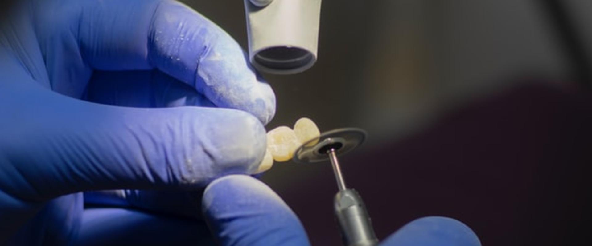 Fém-kerámia Fém-kerámia