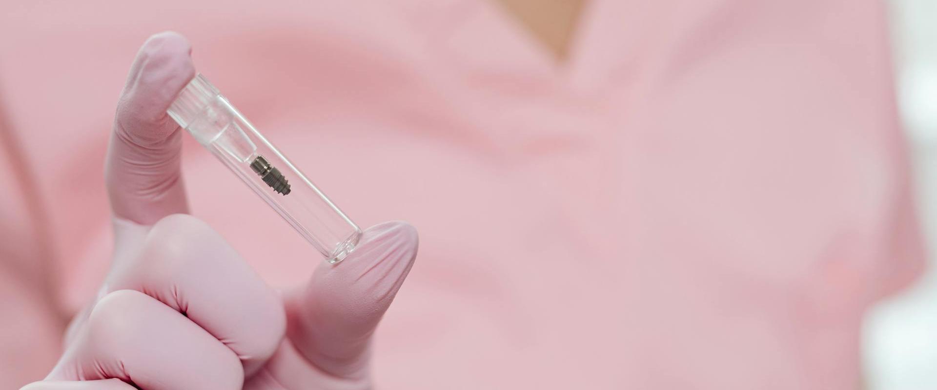 Kinek ajánlott a fogászati implantáció? Kinek ajánlott a fogászati implantáció?