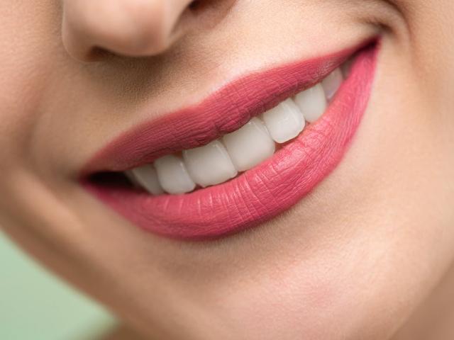 2. eset: Fogszabályozás