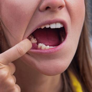 Foghiány kezelése az Invisalign segítségével - Innováció és esztétika egyben