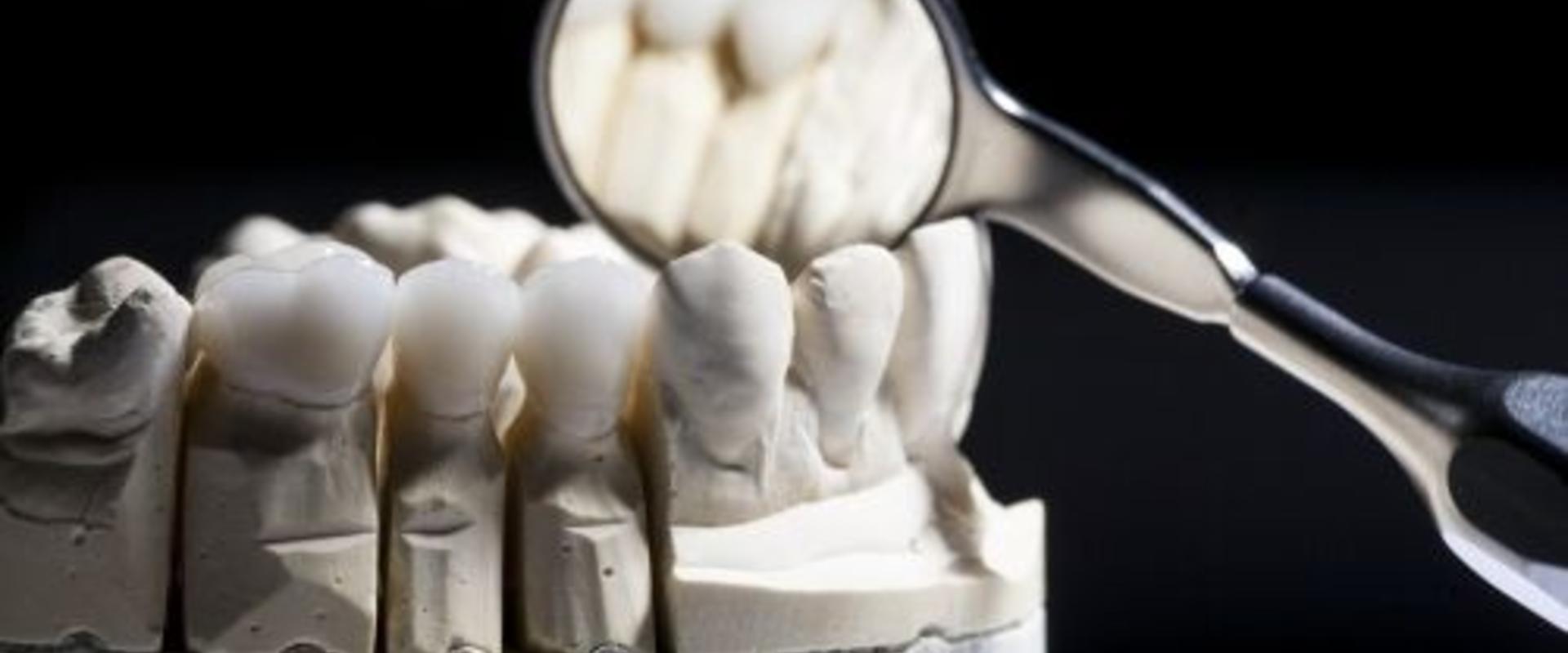 Full cirkónium Full cirkónium